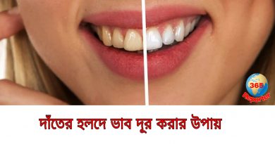 home remedies to whiten your yellow teeth